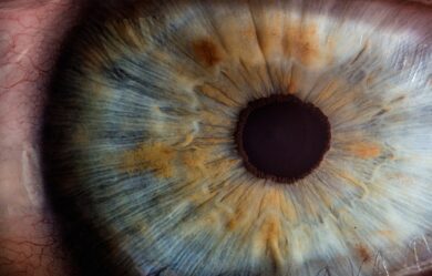 Photo Eye exam